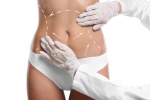 liposuction clinics seoul Mina Plastic Surgery